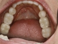 Konig Center for Cosmetic & Comprehensive Dentistry smile photos